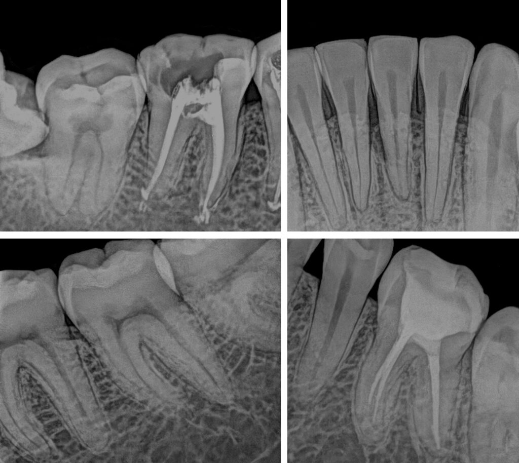 Digital Intraoral Sensor Xpectvision Jagas