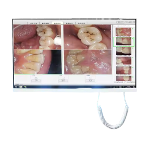 SMART INTRAORAL CAMERA SYSTEM TOUCH SCREEN 21 INCHES