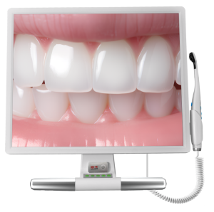 DYM Intra Oral System