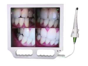 Smart Intraoral Camera System