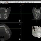 CT1(1)