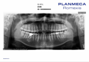 IMG_3525